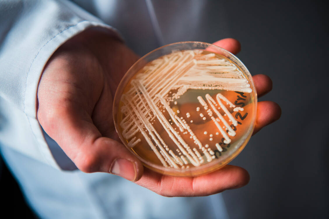 Wie viele Candida-Arten hat C. auris eine glänzende Oberfläche. Der Hefepilz ist potenziell pathogen und kann für Immungeschwächte lebensbedrohlich sein. / Foto: dpa