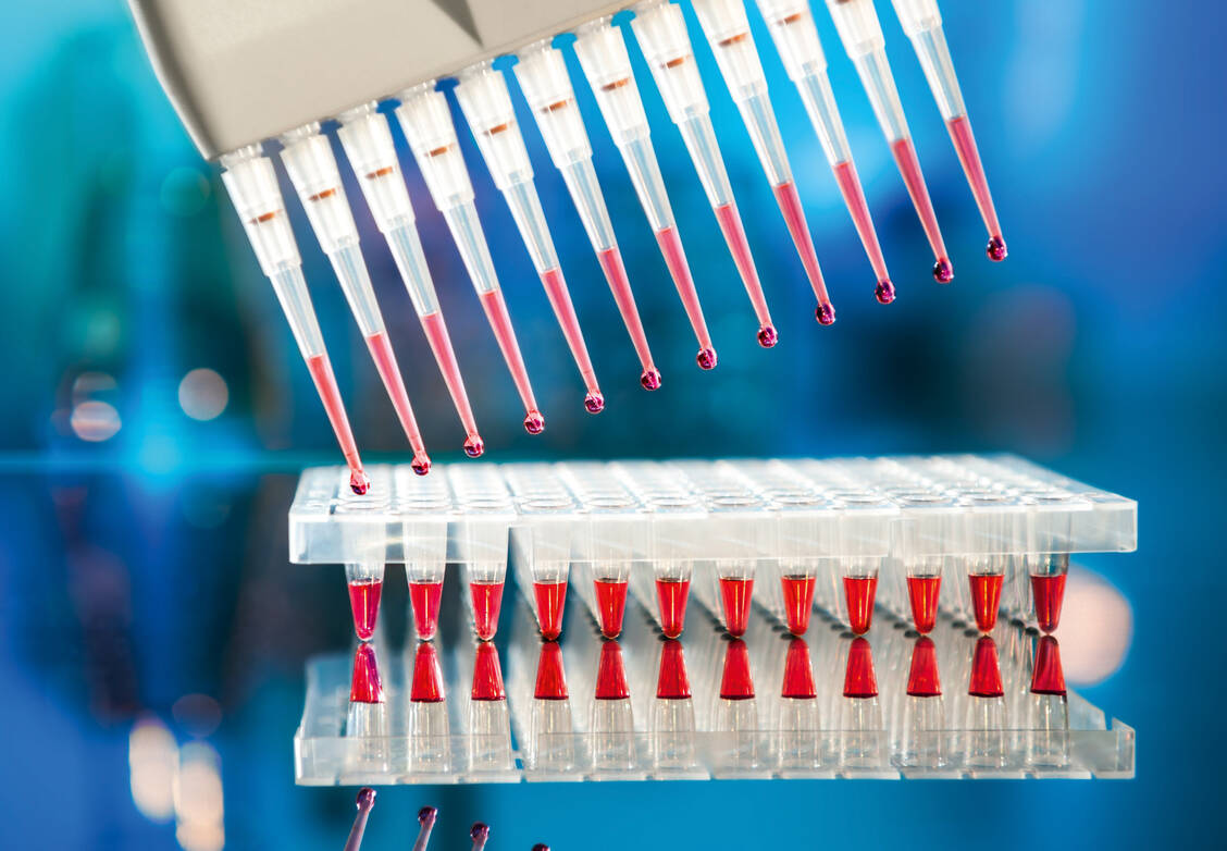 Die molekulare Testung auf das neue Coronavirus mittels PCR wurde in europäischen Laboren rasch implementiert.  / Foto: Fotolia/anyaivanova