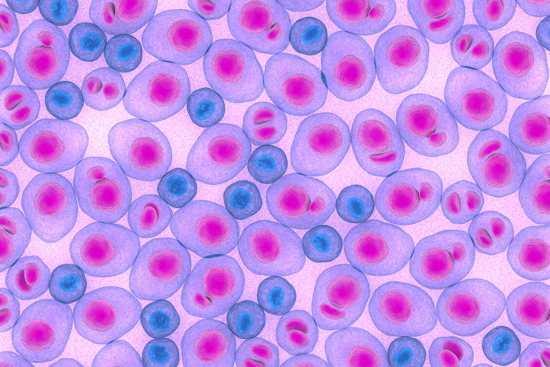 Bei Myelom-Patienten zeigen sich in der Knochenmarksprobe unter dem Mikroskop anormal viele Plasmazellen (Illustration). / Foto: Adobe Stock/LASZLO
