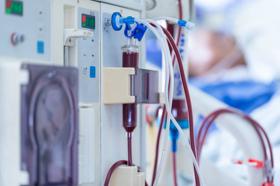 Die häufigsten Ursachen für chronische Niereninsuffizienz sind Diabetes, Bluthochdruck und Glomerulonephritis. In ihrer schwersten Form, dem sogenannten Nierenversagen, sind die Nierenschädigung und die Verschlechterung der Nierenfunktion so weit fortgeschritten, dass eine Dialyse oder Nierentransplantation erforderlich ist. / Foto: Adobe Stock/saengsuriya13