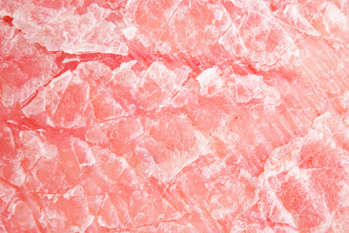Typisch für Psoriasis sind silbrig-weiße Schuppen auf geröteter Haut. / Foto: Adobe Stock/Milan Lipowski