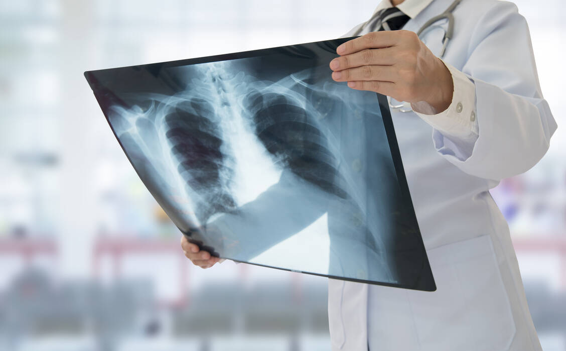 Die Lungenfibrose ist eine chronisch fortschreitende Erkrankung, die sehr viele Ursachen haben kann. Die Patienten leiden zunehmend unter Atemnot. / Foto: Shutterstock/create jobs 51