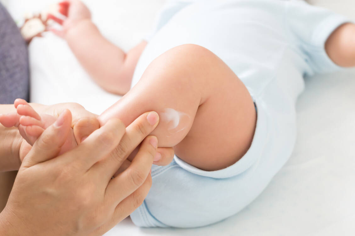Bei Baby- und Kinderhaut ist besondere Sorgfalt angezeigt, da diese aufgrund ihrer noch unausgereiften Hornzellschicht- und Lipidbarriere besonders anfällig für die unerwünschten Wirkungen einer Glucocorticoid-Therapie ist. / Foto: Adobe Stock/comzeal