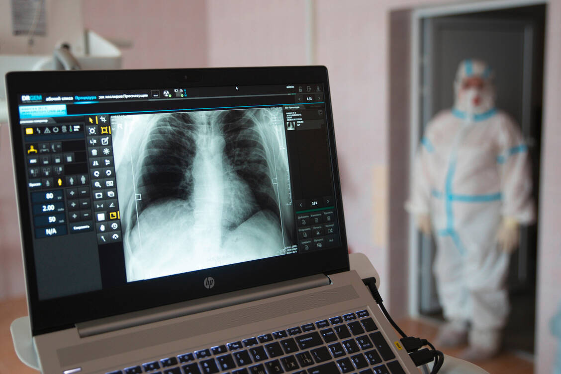 Bei vielen der hospitalisierten Covid-19-Patienten hat sich die Lunge auch Wochen nach der Entlassung nicht vollständig erholt. Ein häufiges Problem sind Lungenfibrosen. / Foto: imago images/ITAR-TASS