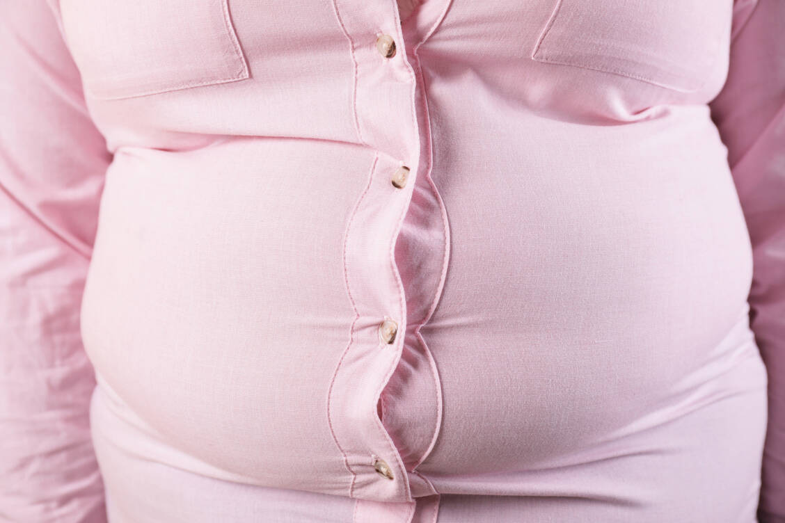 Ein großer Bauchumfang ist ein Kriterium für das metabolische Quartett. Dem viszeralen Fettgewebe kommt eine Schlüsselrolle für das kardiovaskuläre Risiko des Patienten zu. / Foto: Adobe Stock/New Africa