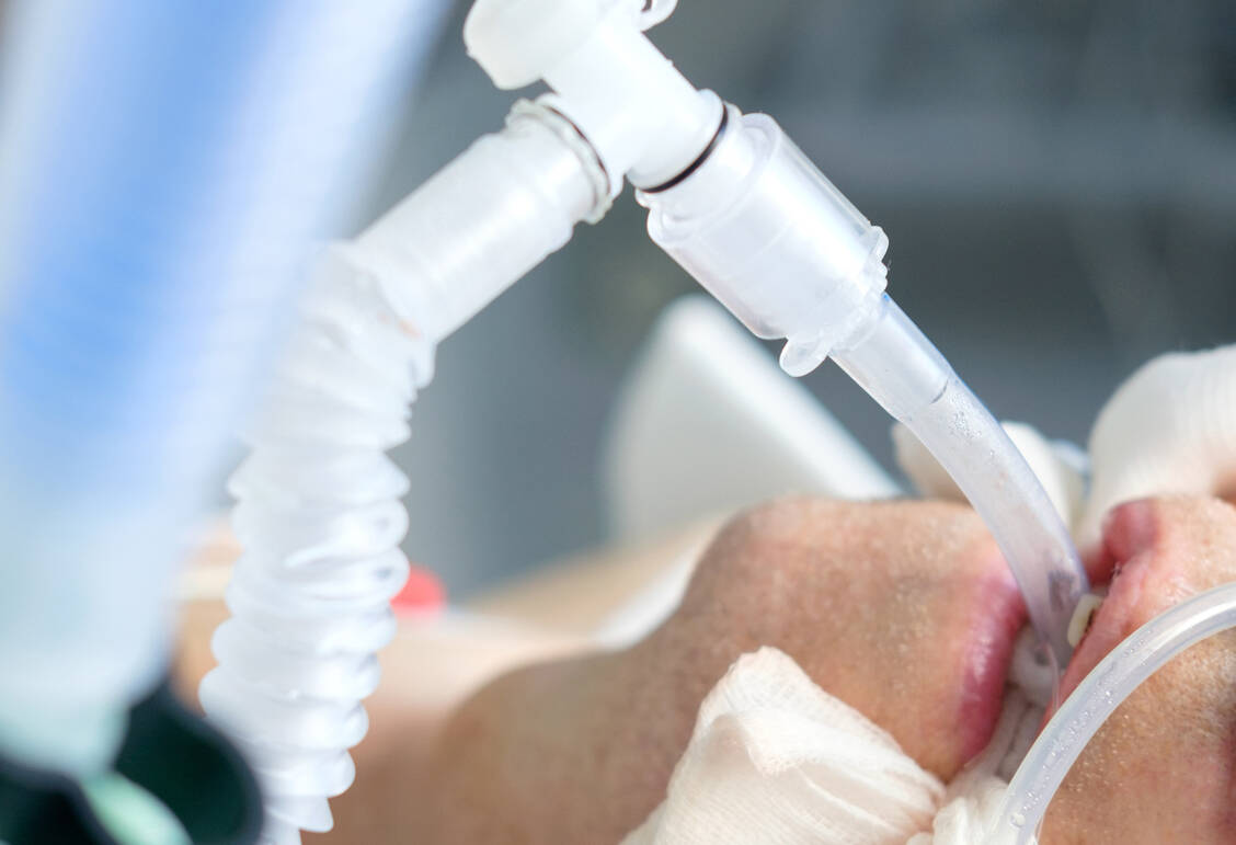 Beim Einsatz von Muskelrelaxanzien müssen die Patienten künstlich beatmet werden, da auch die Atemmuskulatur gelähmt wird. / Foto: Adobe Stock/Kiryl Lis