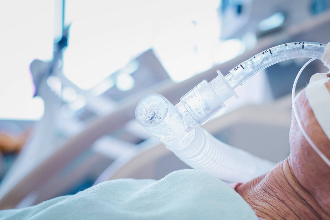 In Deutschland werden derzeit tausende Intensivbetten mit Beatmungsmöglichkeit für Covid-19-Patienten frei gehalten. Noch ist die Lage hierzulande relativ entspannt. Das könnte sich jedoch schnell ändern. / Foto: Getty Images/Taechit Taechamanodom