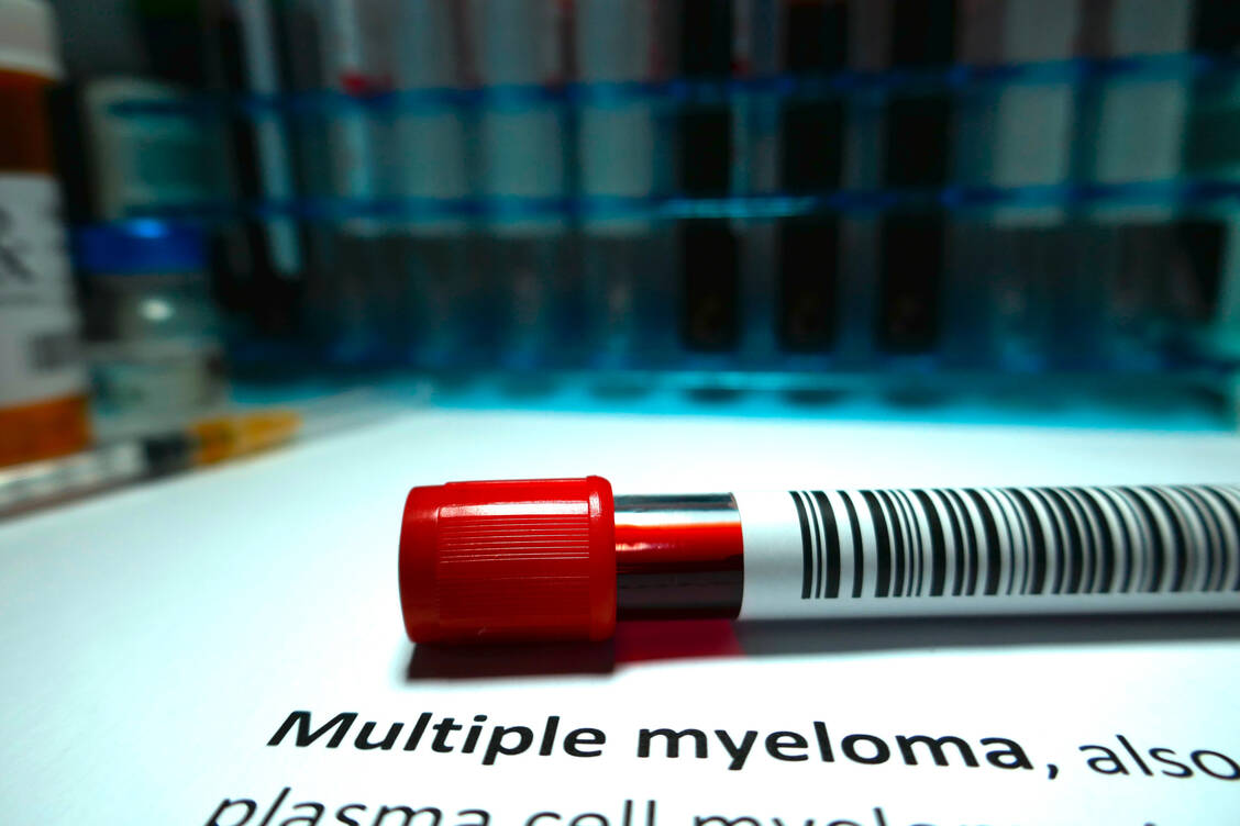 Das Multiple Myelom neigt zu Rezidiven und Betroffene entwickeln häufig eine Therapieresistenz. Mit Elranatamab gibt es nun für stark vorbehandelte Patienten eine neue Option.  / Foto: Gettyimages/ 
Hailshadow