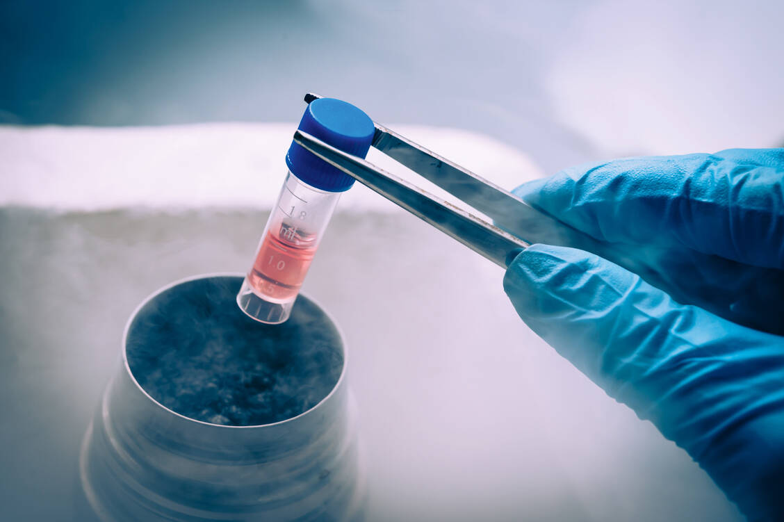 Mesenchymale Stromazellen gelten als Hoffnungsträger, möglicherweise auch für Covid-19-Patienten. / Foto: Shutterstock/Elena Pavlovich