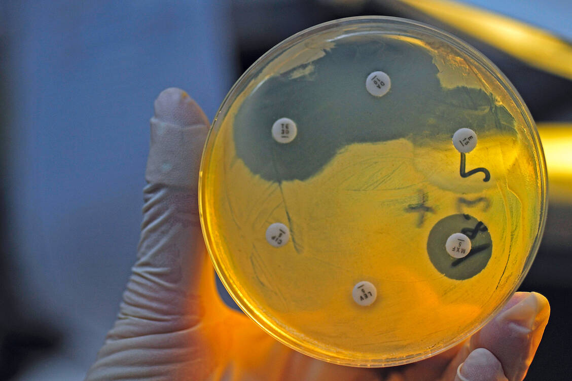 Resistenz kann auf vielen Wegen entstehen. Im Labor kann die Empfindlichkeit von Bakterien gegen bestimmte Antibiotika getestet werden. / Foto: Imago Images/Ralph Lueger