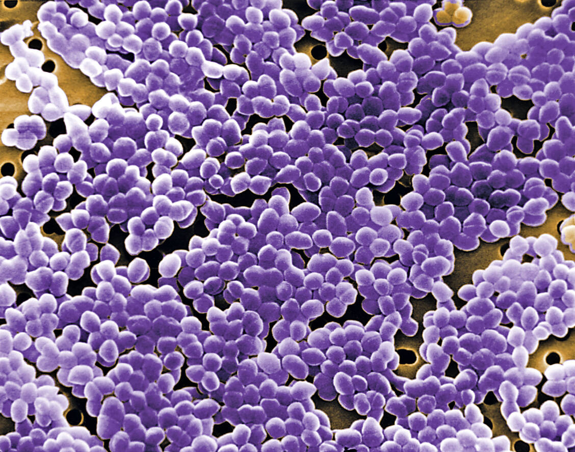 Bestimmte Darmbakterien können den Arzneistoff L-Dopa abbauen und so dessen Wirksamkeit schmälern. / Foto: CDC