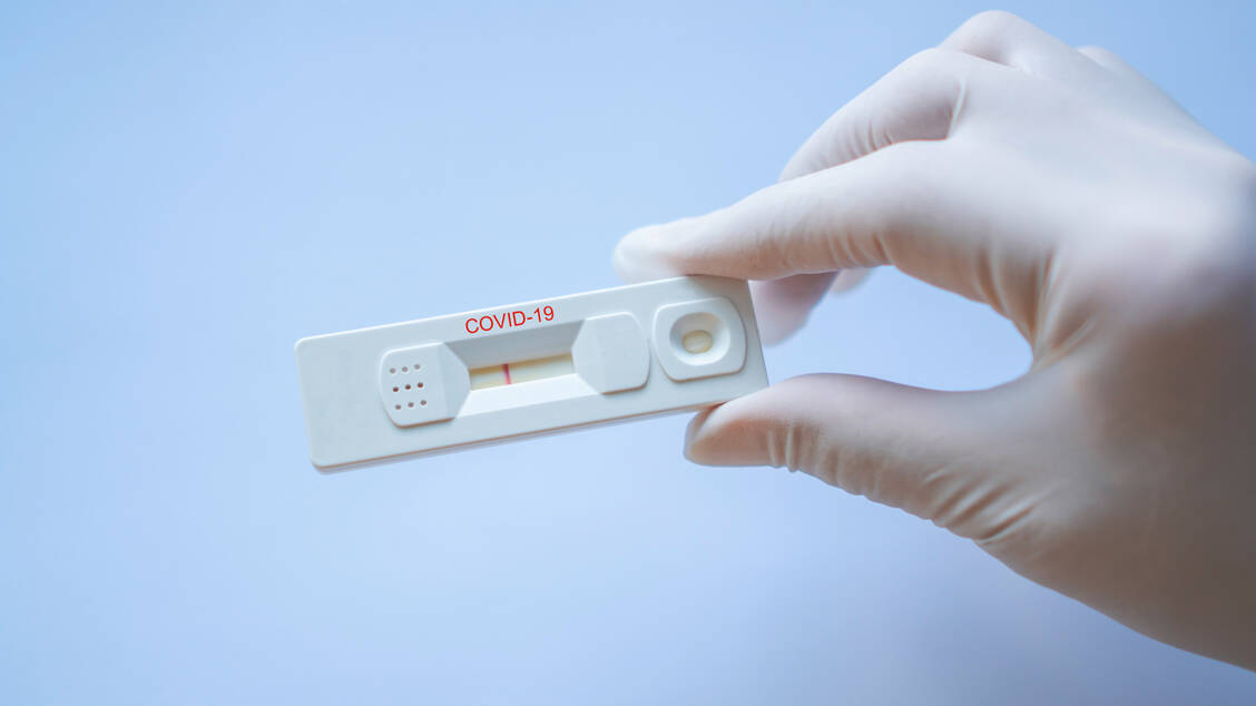 An einfachen Tests, die schnell und zuverlässig, eine SARS-CoV-2-Infektion anzeigen wird weltweit gearbeitet. / Foto: Adobe Stock/sutthinon602