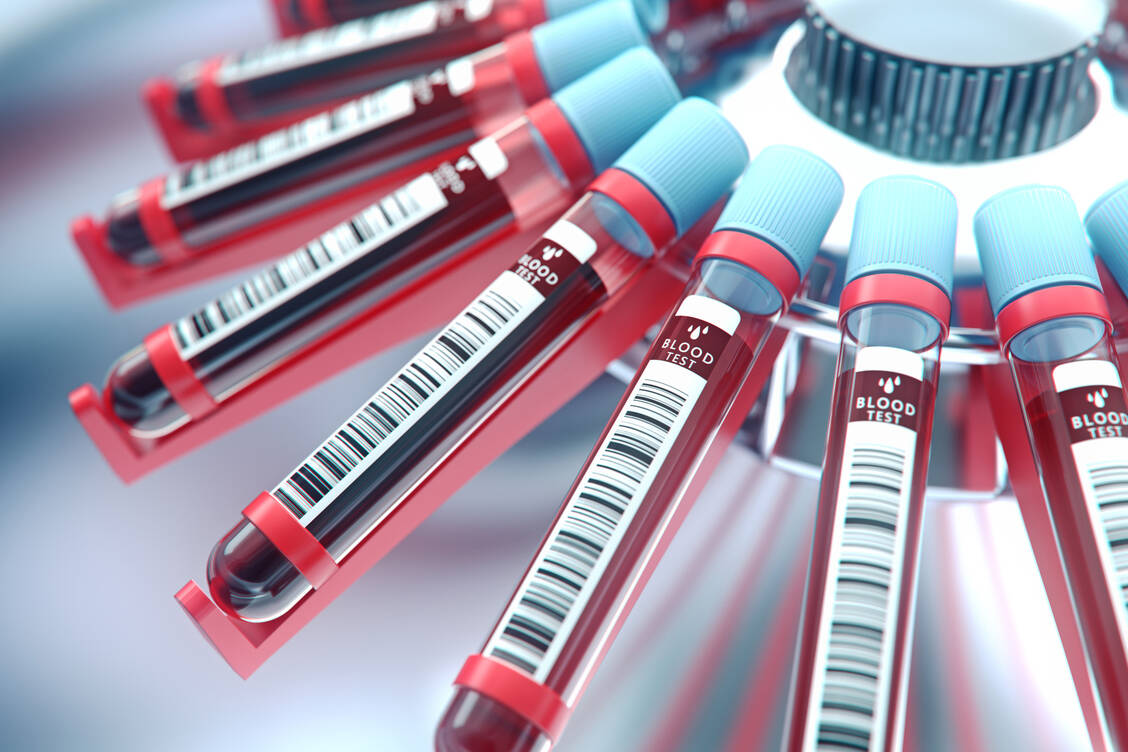 Wie schnell Blut gerinnt, ist entscheidend für das Thromboserisiko. Mit Phenprocoumon wird die Blutgerinnung gehemmt. / Foto: Adobe Stock/Connect world