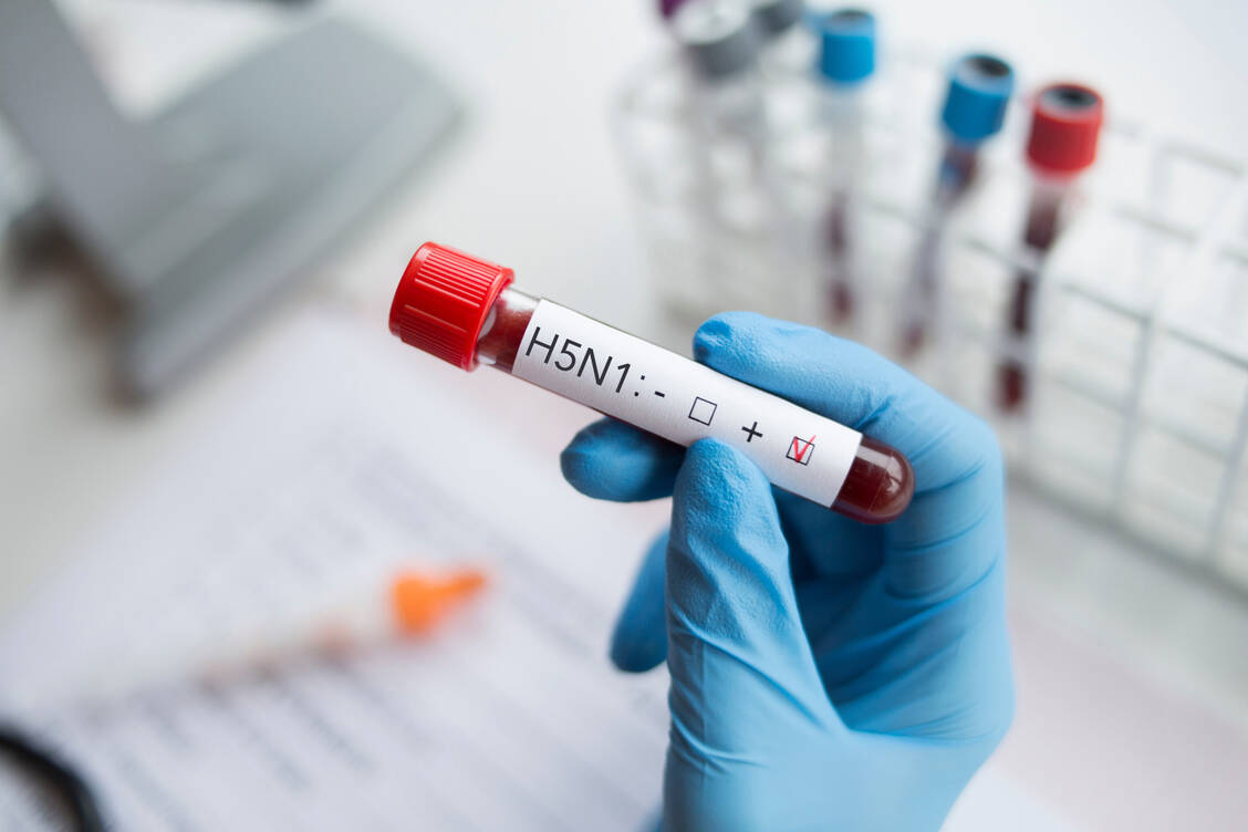In Louisiana ist das Vogelgrippevirus H5N1 bei einem Patienten nachgewiesen worden, der schwer erkrankt ist.  / © Adobe Stock/forma82