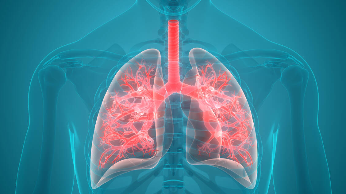 Als Auslöser der Lungenerkrankungen werden Viren vermutet, es handelt sich aber weder um Influenza noch um MERS, SARS oder Vogelgrippe. / Foto: GettyIMages/magicmine