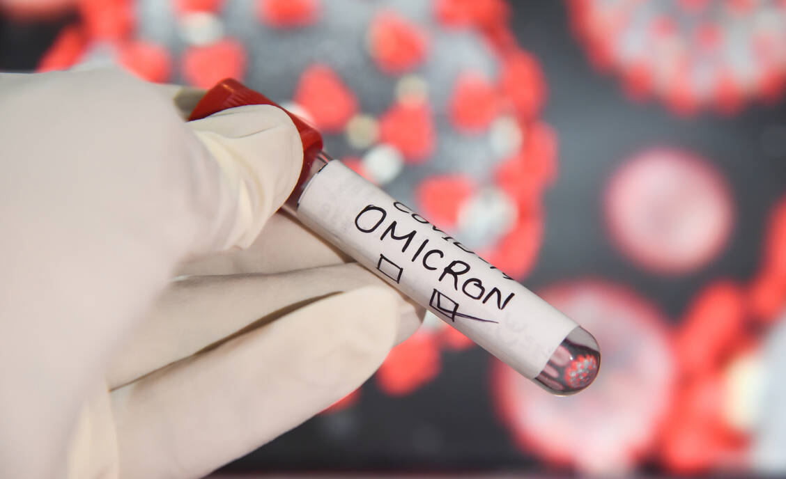 Generell plädieren die Studienautoren für das Vorhandensein eines Omikron-Antigens in einem angepassten Impfstoff. / Foto: Getty Images/David Talukdar