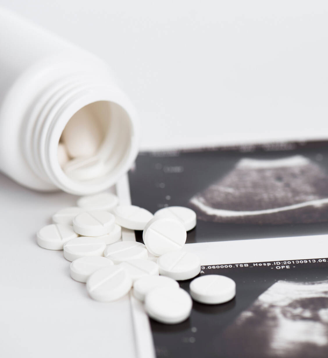 Für medikamentöse Schwangerschaftsabbrüche wird der Progesteronrezeptor-Antagonist Mifepriston eingesetzt. / Foto: Adobe Stock/ivanko80