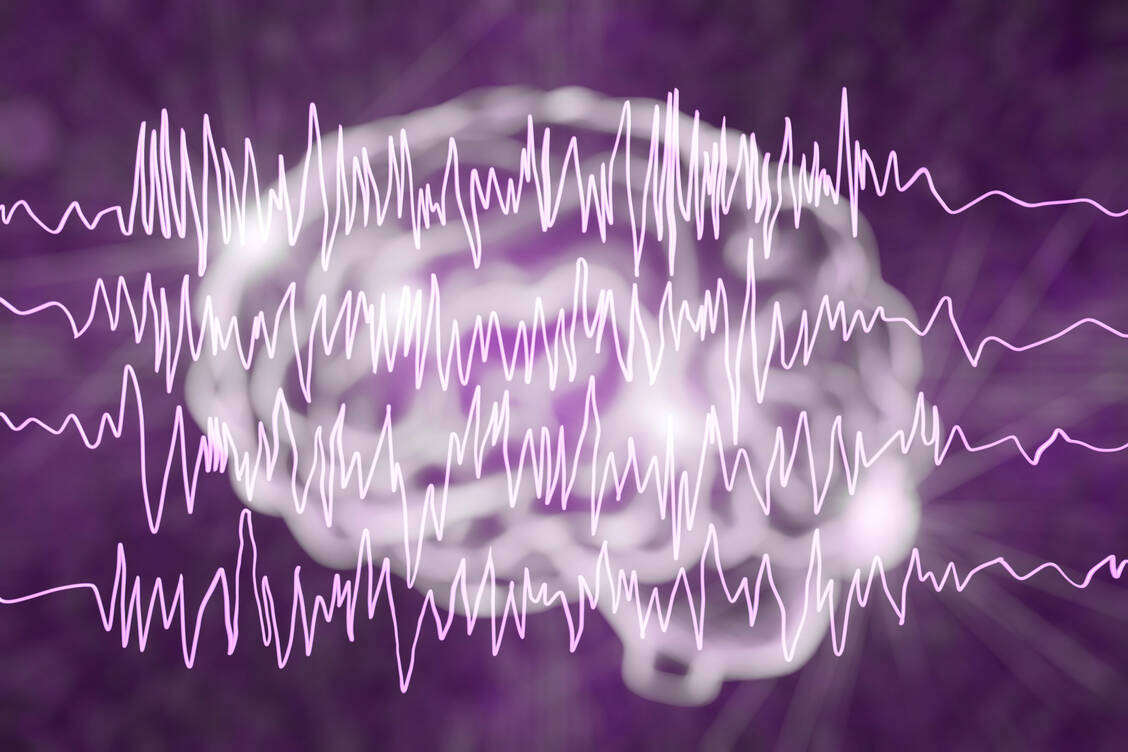 Epileptische Anfälle entstehen im Gehirn. / Foto: Adobe Stock/ Kateryna_Kon