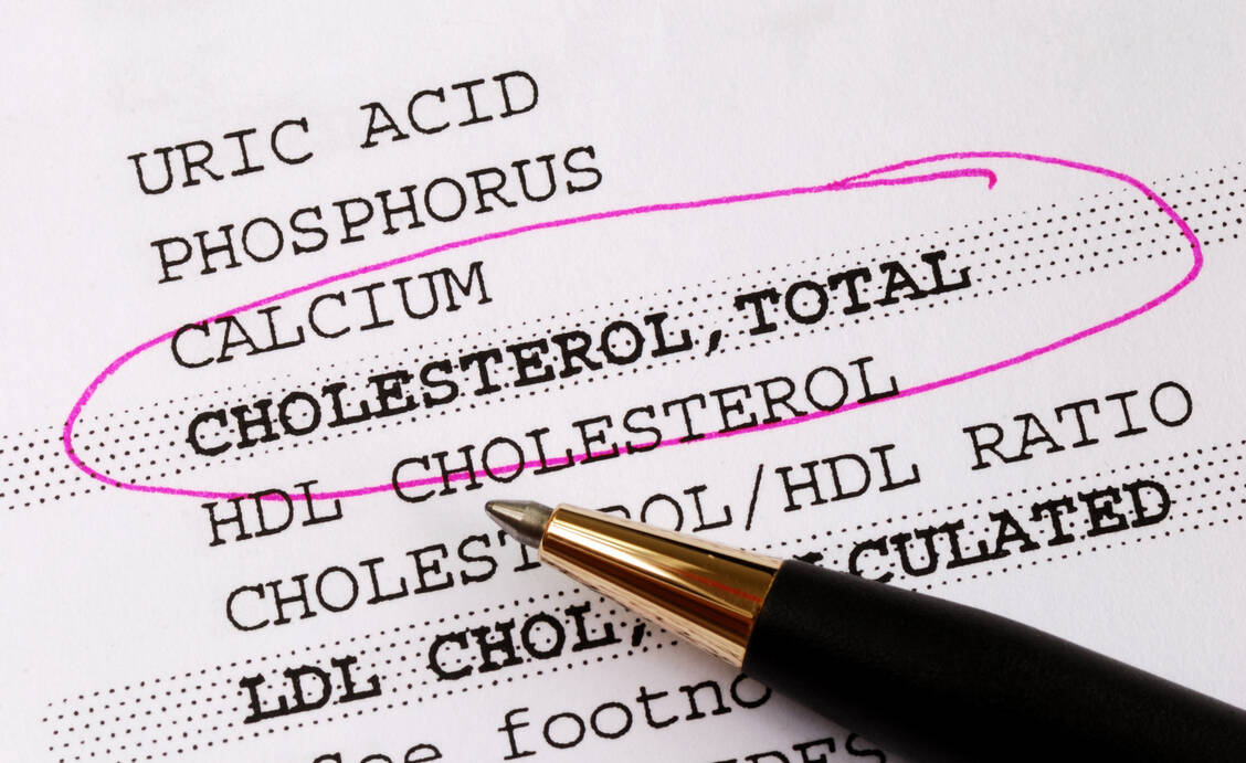 Die neue Studie erhärtet den Verdacht, dass hohe HDL-C-Spiegel bei Menschen mit Typ-2-Diabetes möglicherweise nicht protektiv sind. / © Adobe Stock/JohnKwan
