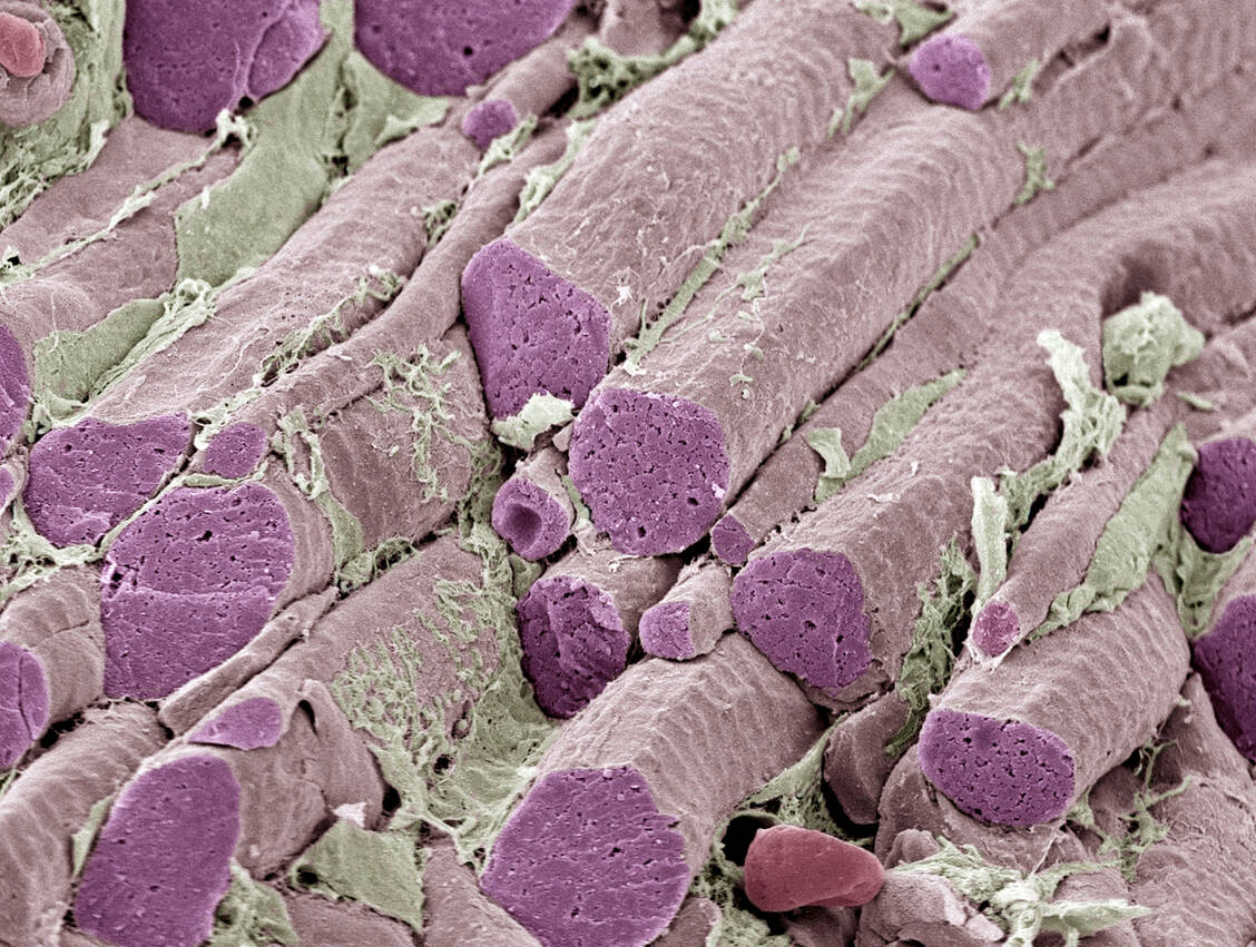 Dystrophin verleiht Muskelzellzellen ihre Struktur. Bei Patienten mit Duchenne-Muskeldystrophie fehlt das Protein, weshalb Muskeln allmählich durch Fett und Bindegewebe ersetzt werden. / Foto: Getty Images/Science Photo Library/Steve Gschmeissner