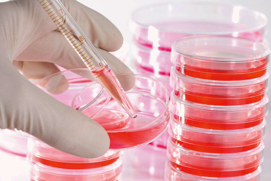 Für seine Untersuchungen zu der Frage, ob die in Impfstoffen enthaltene mRNA in DNA rückübersetzt werden kann, verwendete ein Team aus Lund eine Zelllinie mit ungewöhnlicher Chromosomenausstattung. / Foto: Fotolia/Hoppe