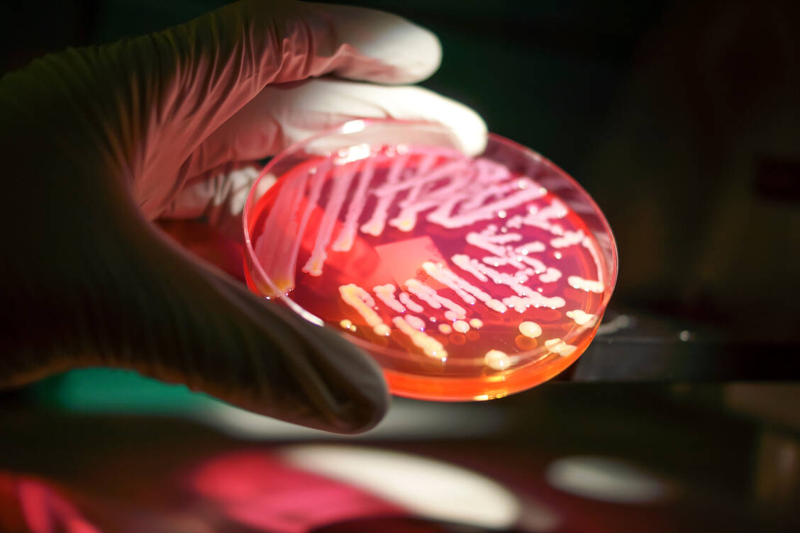 Die WHO hat bereit seit 2017 eine Prioritätenliste mit zwölf resistenten Bakterien, gegen die dringend Antibiotika oder Impfstoffe entwickelt werden müssten. / Foto: Getty Images/Rodolfo Parulan Jr.