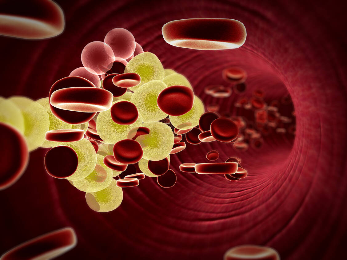 Lipoprotein(a) ist ein Risikofaktor für Herz-Kreislauf-Erkrankungen, der einmal im Leben bestimmt werden sollte. / © Getty Images/Ugreen