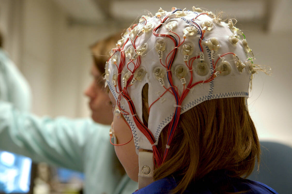 Kinder mit CDKL5-Defizienz leiden unter häufigen schweren epileptischen Anfällen. Ihre Hirnentwicklung ist gestört. / Foto: Getty Images/fotografixx