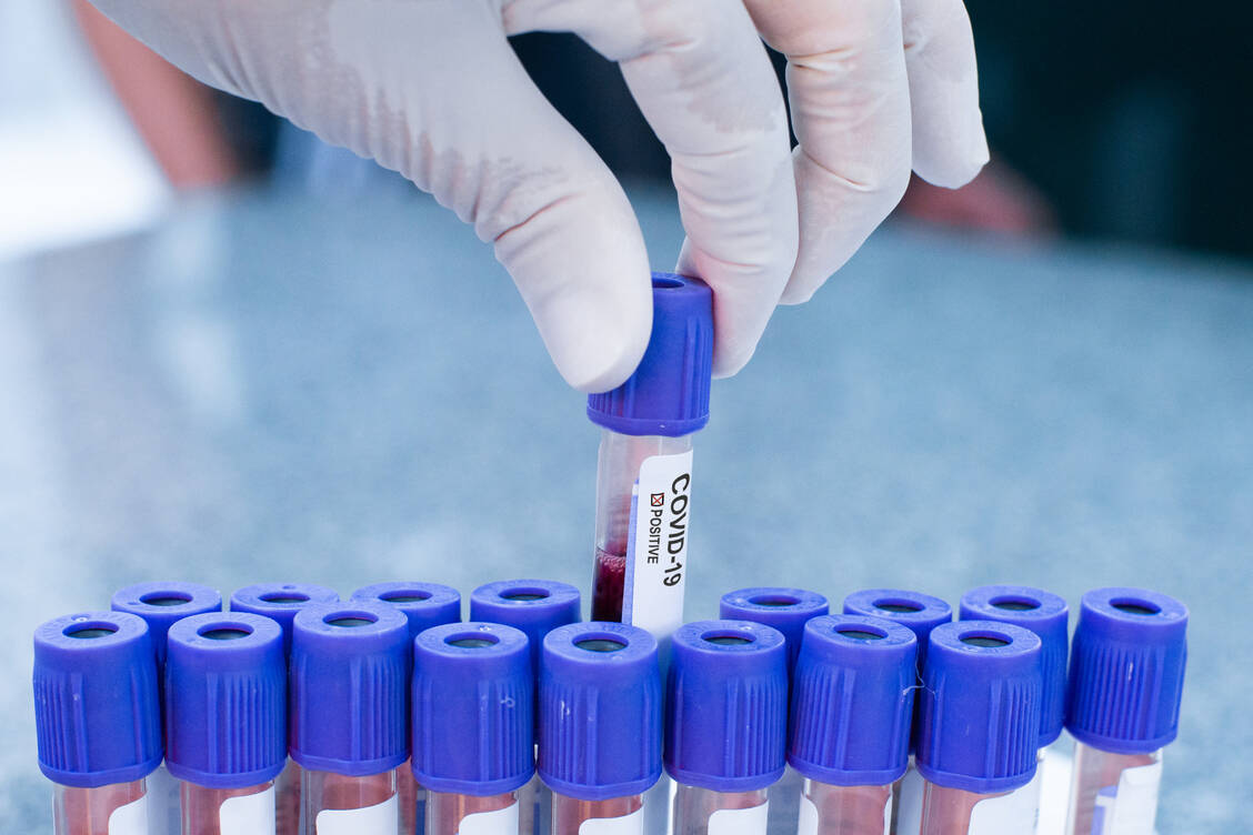 Deutschland hat die Marke von 1 Million nachgewiesener SARS-CoV-2-Infektionen offiziell überschritten. / Foto: Getty Images/Lucas Ninno