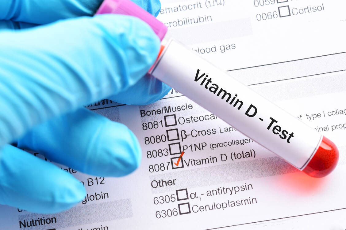 Viele Covid-19-Erkrankte haben einen zu niedrigen Vitamin-D-Spiegel. Umstritten ist, ob dies schon vor der Infektion der Fall war und diese begünstigt hat oder ob umgekehrt die Infektion den Spiegel senkt. / Foto: Adobe Stock/jarun011