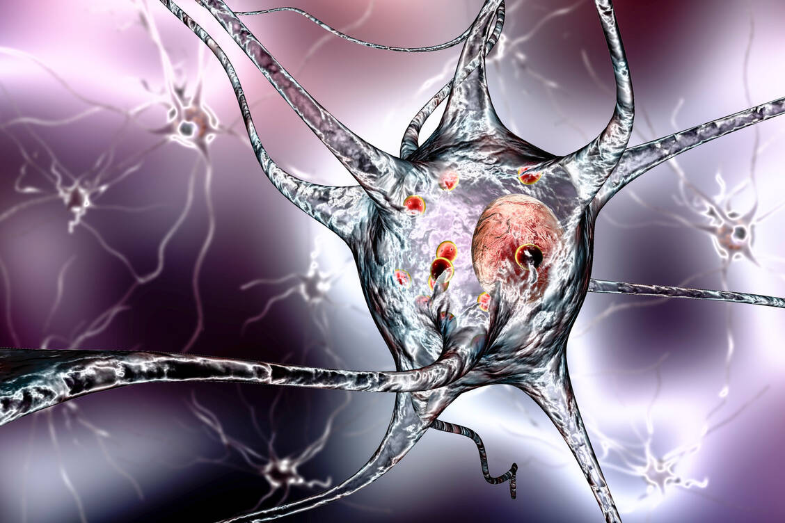 Bei Morbus Parkinson bilden sich Proteinaggregate in dopaminergen Neuronen, die daraufhin absterben. Besonders ein Typ dieser Dopamin produzierenden Nervenzellen ist hierfür anfällig. / Foto: GettyImages/  Kateryna Kon/ Science Photolibrary