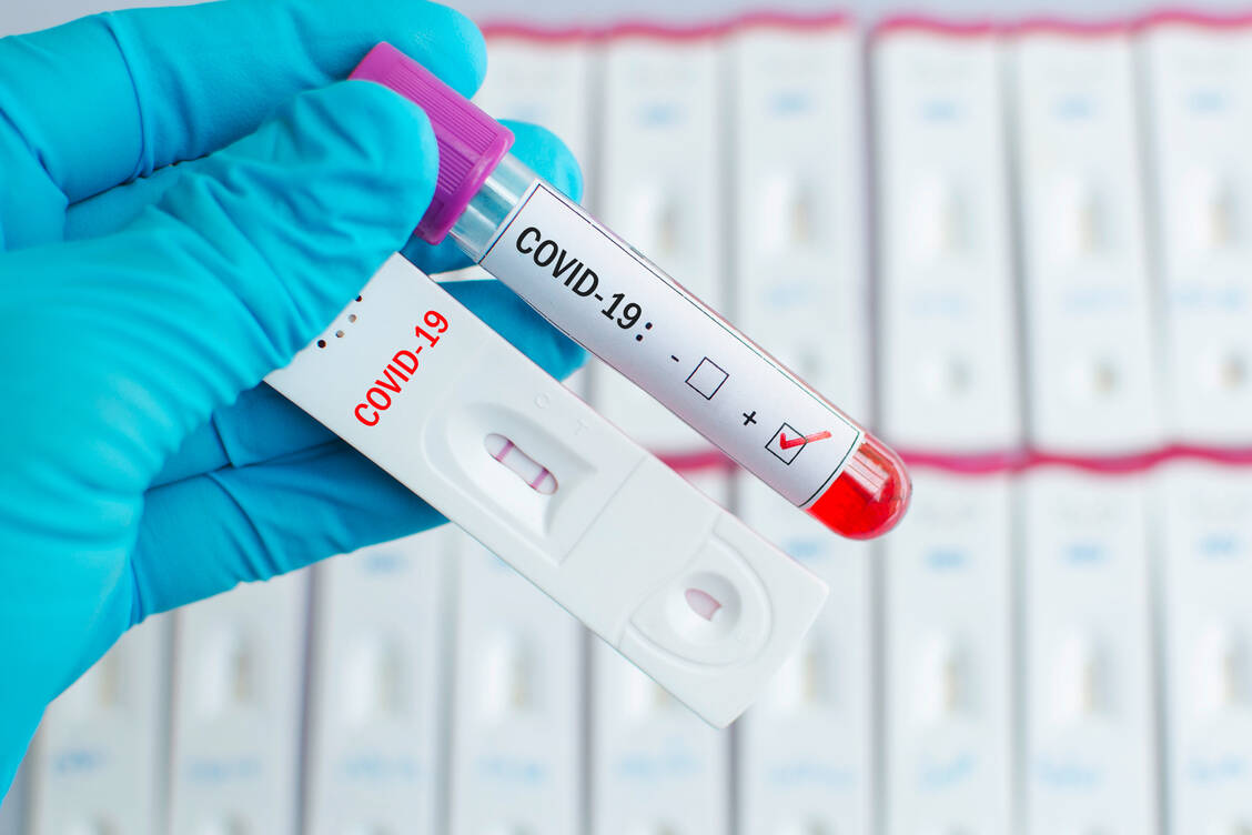 Lediglich 1,3 Prozent der untersuchten Blutspender trägt bereits Antikörper gegen das neuartige Coronavirus in sich. Das ergaben Untersuchungen des RKI. / Foto: Adobe Stock/jarun011