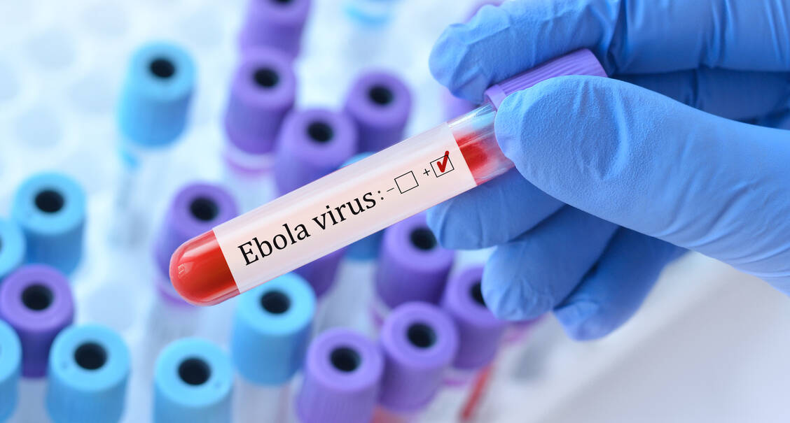 Die Hilfsorganisation Ärzte ohne Grenzen hält eine kontrollierte Versorgung von Ebola-Infizierten für möglich. / © Getty Images/SyhinStas