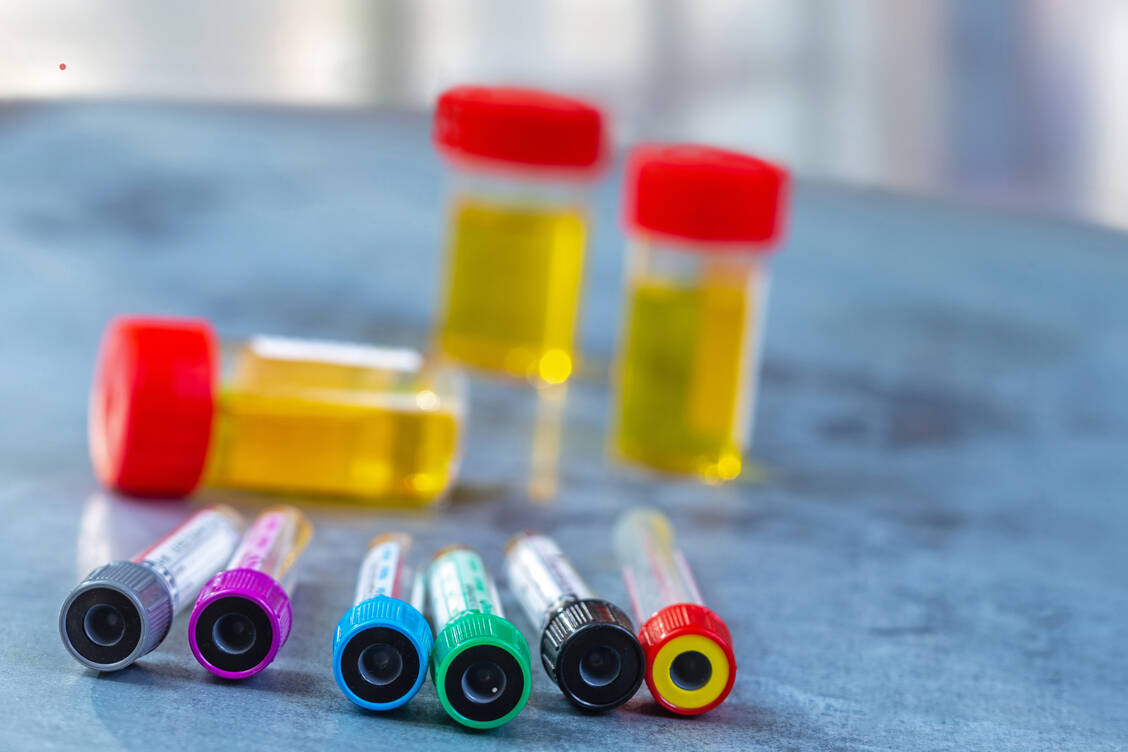 Die digitale Transformation hält der VDGH für eine Chance, die internationale Wettbewerbsfähigkeit der Diagnostika-Industrie zu stärken. / Foto: Adobe Stock/JPC-PROD