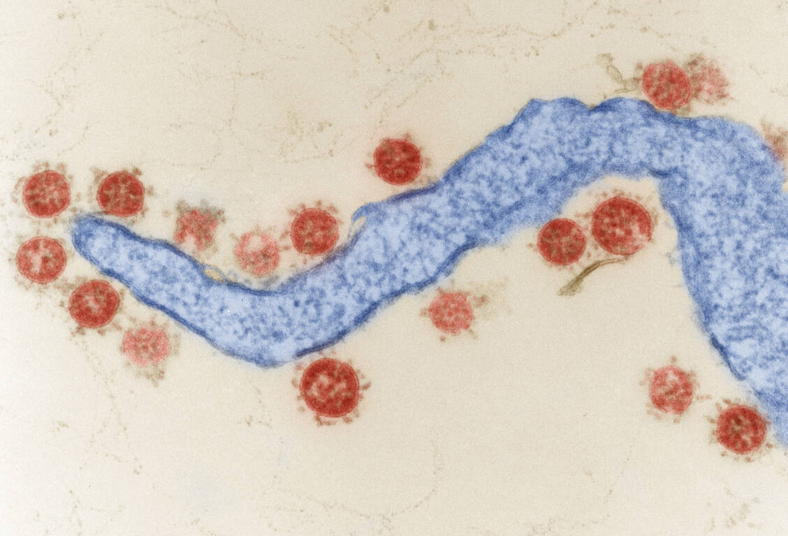 Die Evolution des Coronavirus SARS-CoV-2 schreitet voran. Neuerdings zeigen sich Parallelentwicklungen bei verschiedenen Omikron-Subvarianten. / Foto: Hans R. Gelderblom, Freya Kaulbars/RKI