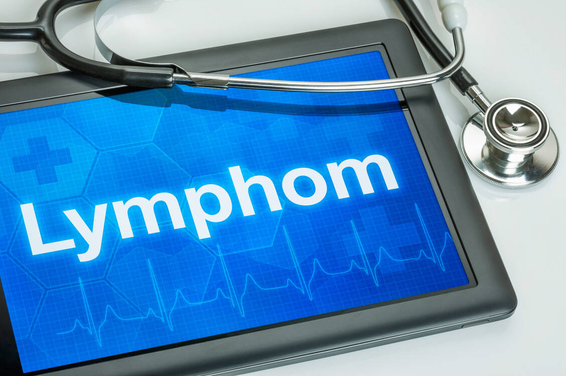 Das diffus großzellige B-Zell-Lymphom (DLBCL) ist ein aggressives und rasch wachsendes Lymphom. Zur Behandlung steht nach dem zweiten Rezidiv für Betroffene mit dem Antikörper Glofitamab ein neuer Wirkstoff zur Verfügung. / Foto: Adobe Stock/ Zerbor