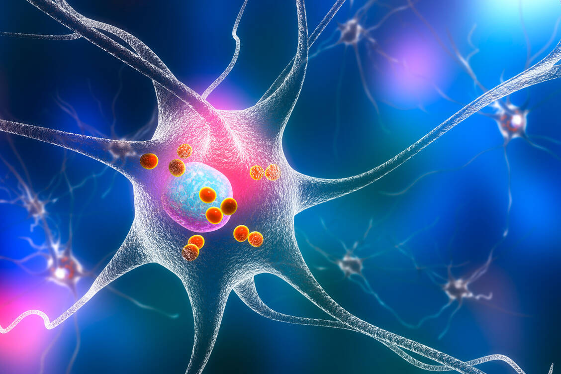 Sind Lewy-Körperchen vorhanden oder pathologische Genvarianten? Wie sieht die Neurodegeneration genau aus? Eine neue Einteilung der Parkinson-Krankheit anhand dieser Kriterien könnte spezifische Therapien vorantreiben. / Foto: Adobe Stock/Kateryna_Kon