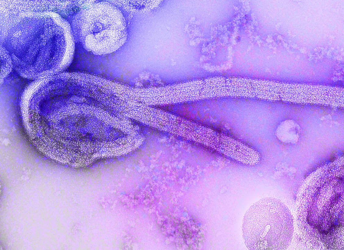 Das fadenförmige Marburg-Virus gehört zu der Familie Filoviridae. / Foto: CDC/