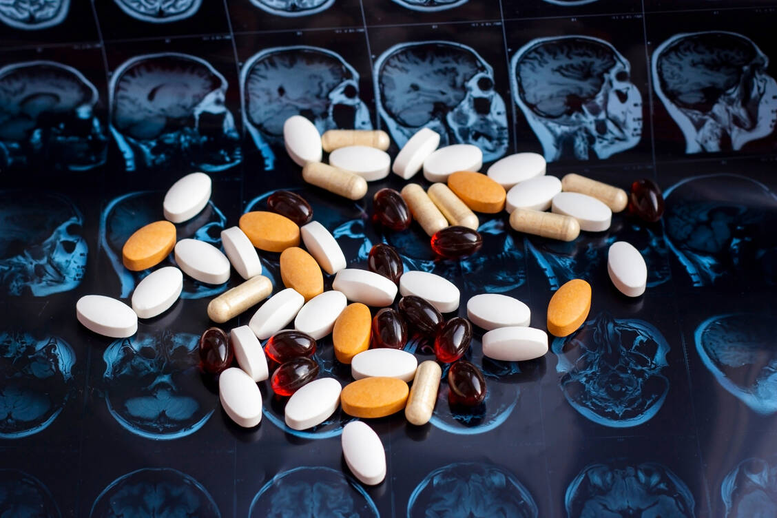 Gewisse ADHS-Medikamente könnten auch zur Behandlung bestimmter Alzheimer-Symptome von Vorteil sein. Größere Studien sind allerdings notwendig, um dazu noch bessere Aussagen treffen zu können. / Foto: Adobe Stock/ Katsiaryna