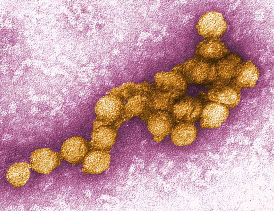 Das West-Nil-Virus ist, was seinen Vektor angeht, nicht wählerisch – wohl aber bezüglich der Temperatur, die es zur Vermehrung braucht. / Foto: CDC/P.E. Rollin/Cynthia Goldsmith