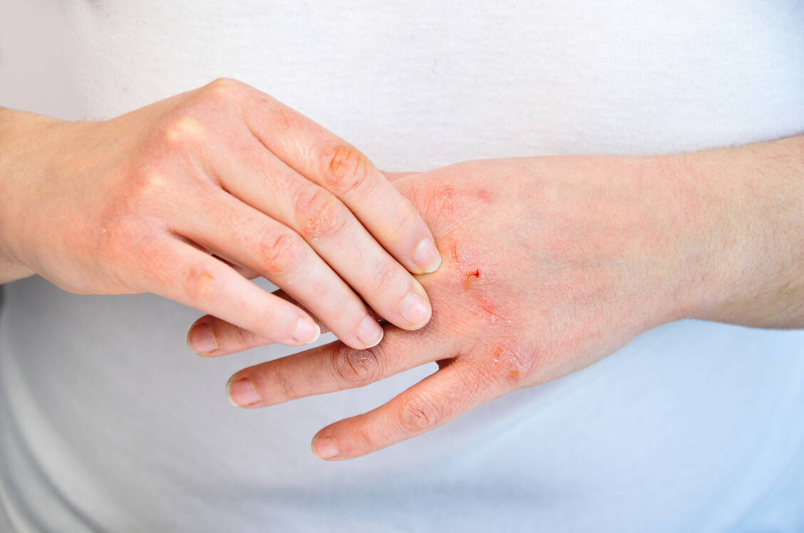 Häufiges Händewaschen kann die Hautbarriere schädigen. Daher sollte die Hautpflege nicht zu kurz kommen. / Foto: Getty Images/Cunaplus_M.Faba