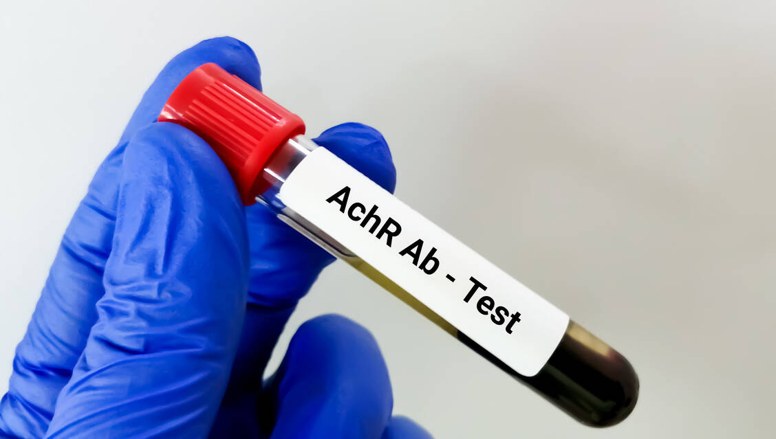 Ein Teil der Patienten mit Myasthenia gravis entwickelt Autoantikörper gegen den Acetylcholinrezeptor. Sie könnten von Nipocalimab profitieren.   / © Adobe Stock/Saiful52