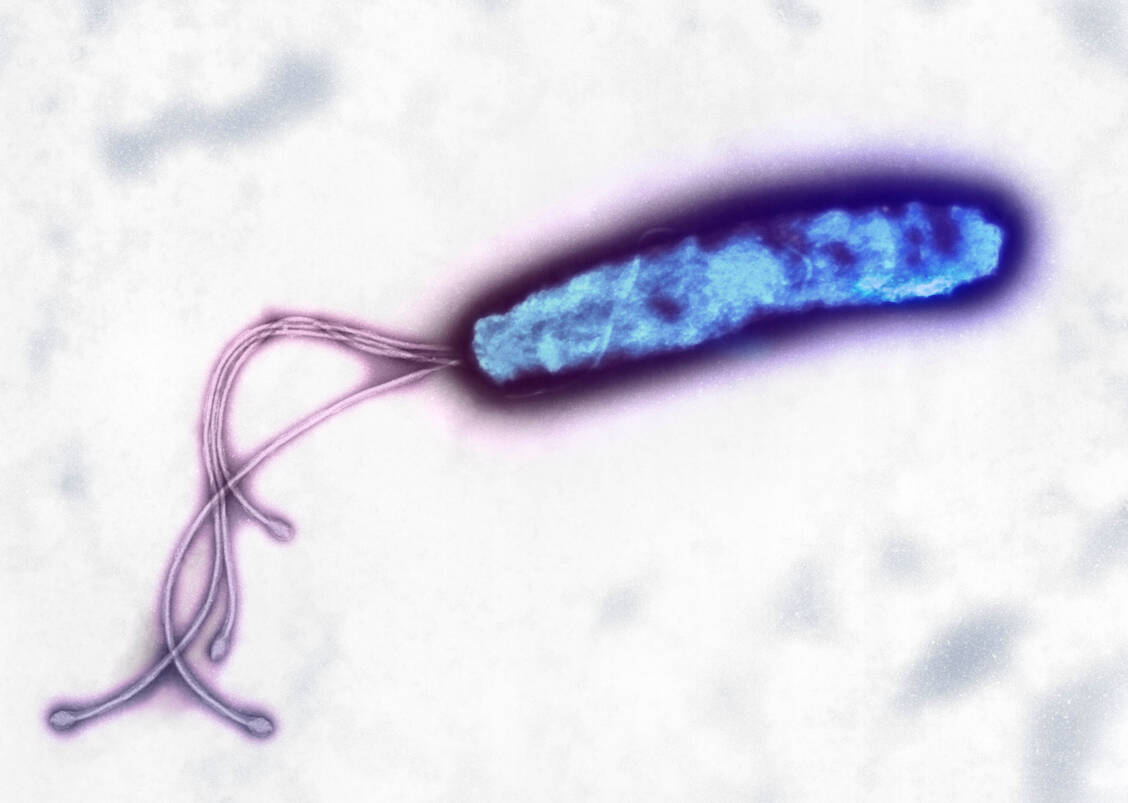 Das gramnegative Stäbchenbakterium Helicobacter pylori überlebt im sauren Milieu des menschlichen Magens und ruft eine chronische Gastritis hervor. / Foto: Getty Images/Science Photo Library/Heather Davies
