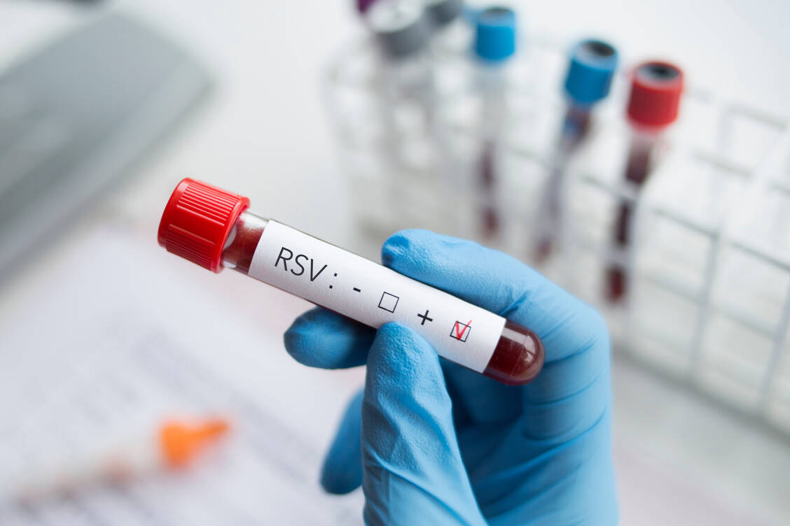 Eine RSV-Infektion kann insbesondere bei Neugeborenen und Säuglingen sowie bei älteren Menschen einen schweren Verlauf nehmen. Seit 2023 gibt es für die junge Risikogruppe einen neuen Antikörper zur passiven Immunisierung: Nirsevimab. / Foto: Adobe Stock/ forma82