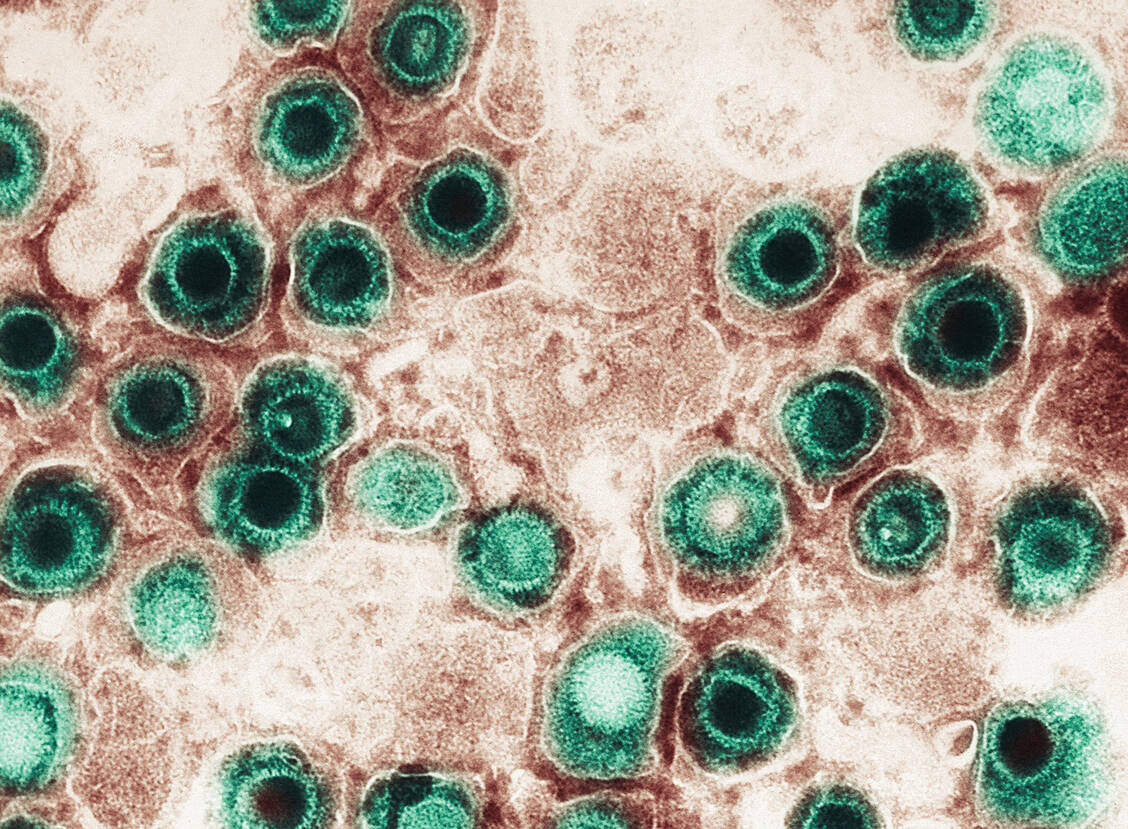 Herpesviren eines bestimmten Subtyps können wahrscheinlich das Risiko einer späteren MS-Erkrankung erhöhen. / Foto: Getty Images/Callista Images