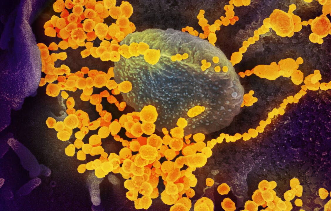 In jedem Infizierten hat das SARS-Coronavirus-2 bei den Replikationen des Ergbguts die Chance, Mutationen zu entwickeln. / Foto: NIAID