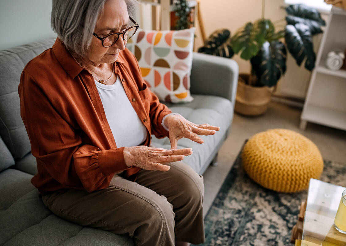Erste Anzeichen einer rheumatoiden Arthritis sind meist warme, geschwollene oder gerötete Gelenke. Typischerweise ist eine Symmetrie erkennbar, beispielsweise können beide Daumen betroffen sein.   / Foto: Getty Images/eclipse_images