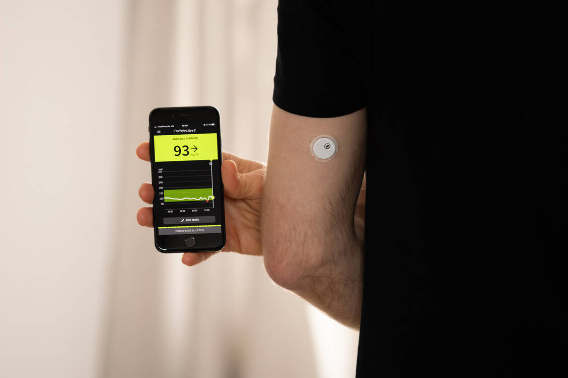 Bei Typ-1-Diabetes weit verbreitet, bei Typ-2-Diabetes noch nicht: Sensoren zur kontinuierlichen Glucosemessung. Es gibt aber Gründe dafür, dass die Sensoren auch bei Menschen mit Typ-2-Diabetes genutzt werden. / © Adobe Stock/ Felix Geringswald