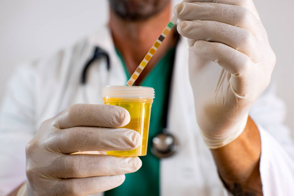 Bei einer asymptomatischen Bakteriurie sind Bakterien im Urin zu finden, ohne dass der Patient Beschwerden hat. / © Adobe Stock/Israel