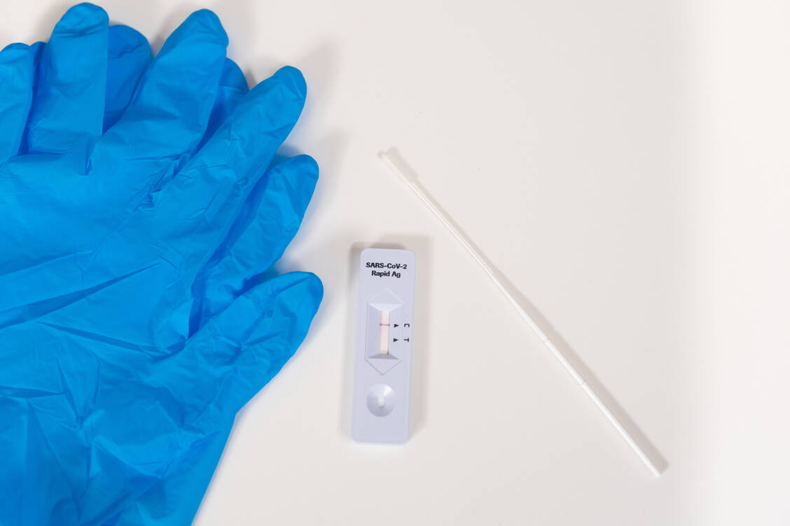 Die Schnelltests sollte es eigentlich ab 1. März kostenlos für alle geben. Dies wird sich aber ersteinmal verzögern.  / Foto: Adobe Stock/Daniel Beckemeier